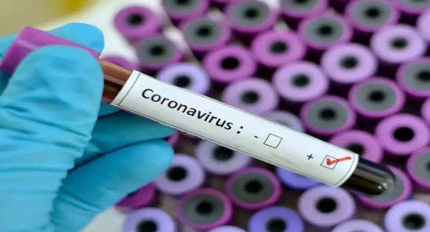 The Weekend Leader - Covid-19 virus test results may vary based on time of day: Study